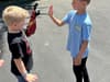 Boy, 5, rides scooter hours after becoming youngest ever person to get bionic arm in incredible footage